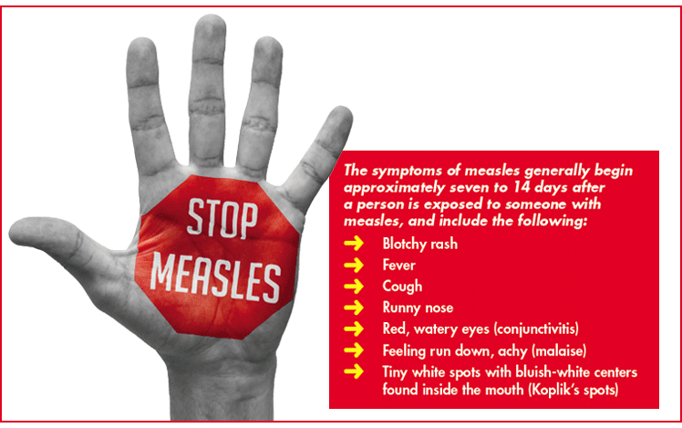 Medical Advice: What you need to know about the measles