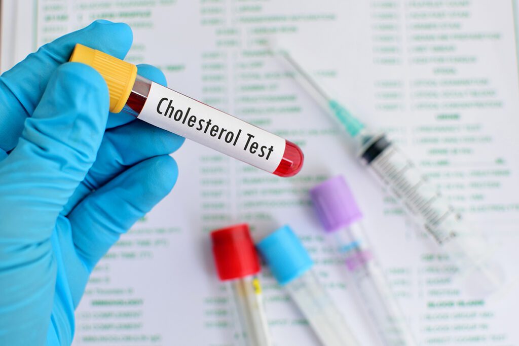 Pop Quiz! Cholesterol: The Good, the Bad, and the Power to Change