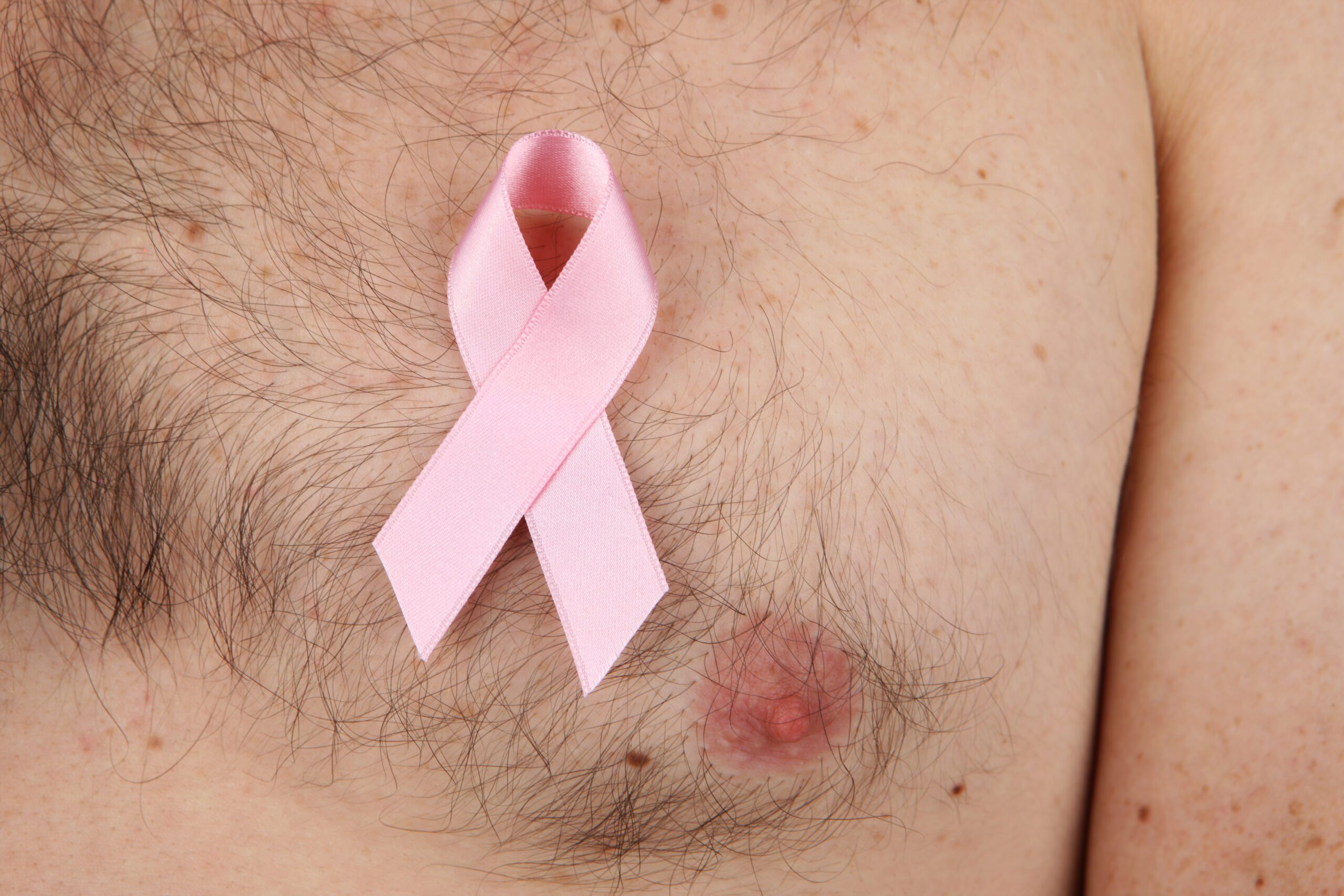Men Aren’t Immune to Breast Cancer