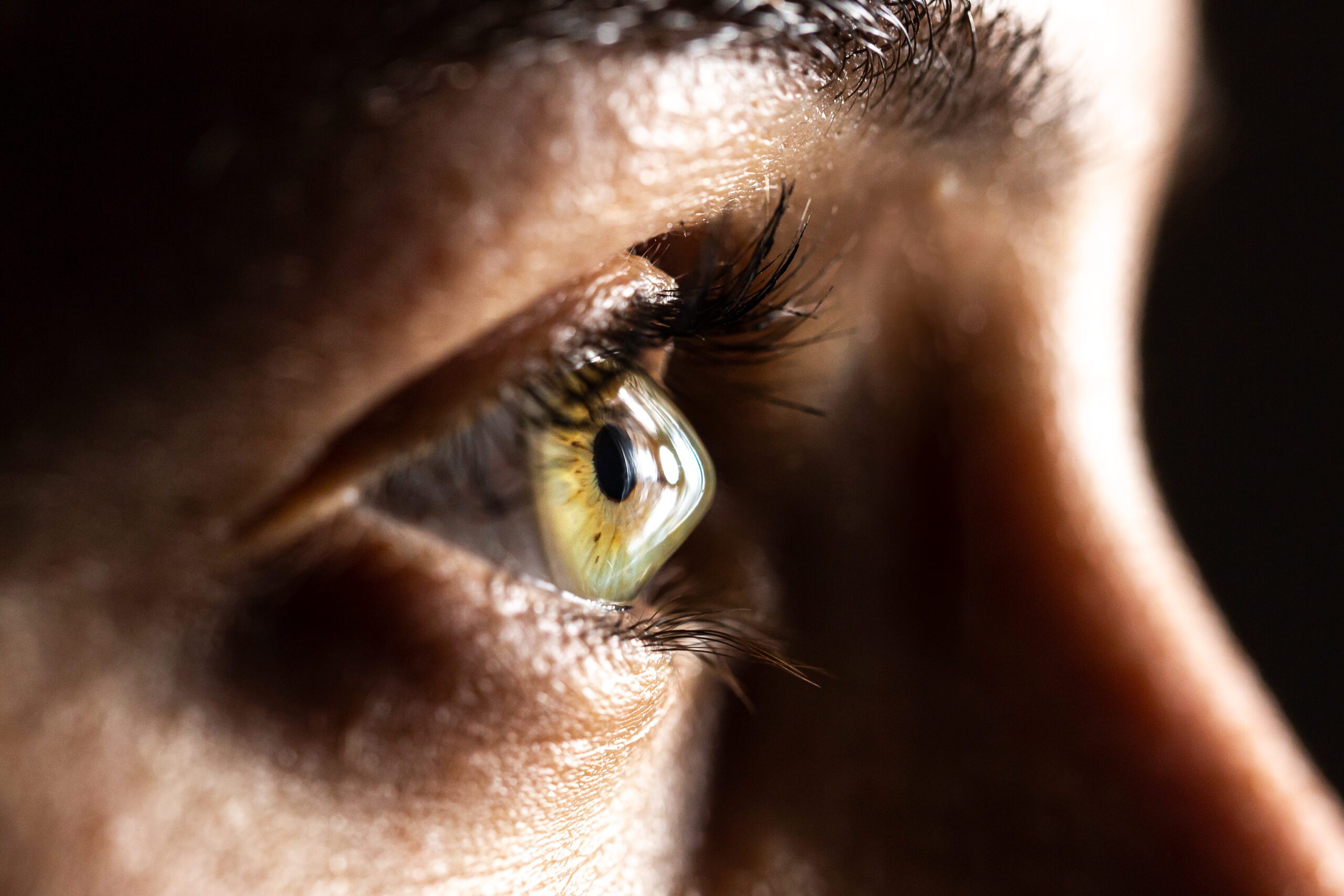 The Eye Condition You’ve Probably Never Heard of: Keratoconus